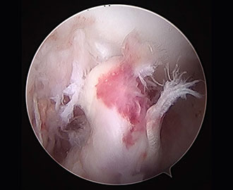 scope camera shows ACL tears in pet Spry Companions Veterinary Orthopedic Specialists Centennial, Colorado