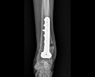 X-ray of limb deformity correction in dog Spry Companions Veterinary Orthopedic Specialists Centennial, Colorado