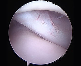 arthroscopy scope view camera animal orthopedics Spry Companions Veterinary Orthopedic Specialists Centennial, Colorado